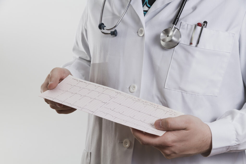 Doctor holding an ECG printout
